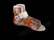 Orteza de picior supramaleolara // S.M.O (supramaleolar orthosis)