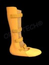 Proteză parţială de picior - Pirogoff; Proteză pentru dezarticulaţie de gleznă - Syme // Partial foot prosthesis - Pirogoff; Ankle disarticulation prosthesis - Syme