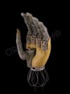 Proteza bionica ”i-limb hand” - pentru dezarticulatie incheietura mainii