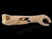 Proteză de antebraţ funcţională mioelectrică // Myoelectrically controlled below-elbow prosthesis