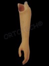 Proteză de antebraţ funcţională simplă // Cosmetic below-elbow prosthesis