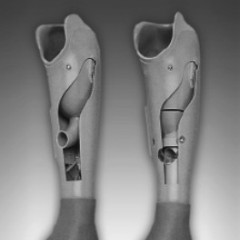 PROTEZA DE ANTEBRAT ACTIONATA MIOELECTRIC