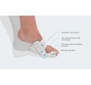 Orteza pentru hallux-valgus - Hallufix