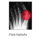 Orteza pentru hallux-valgus - Hallufix